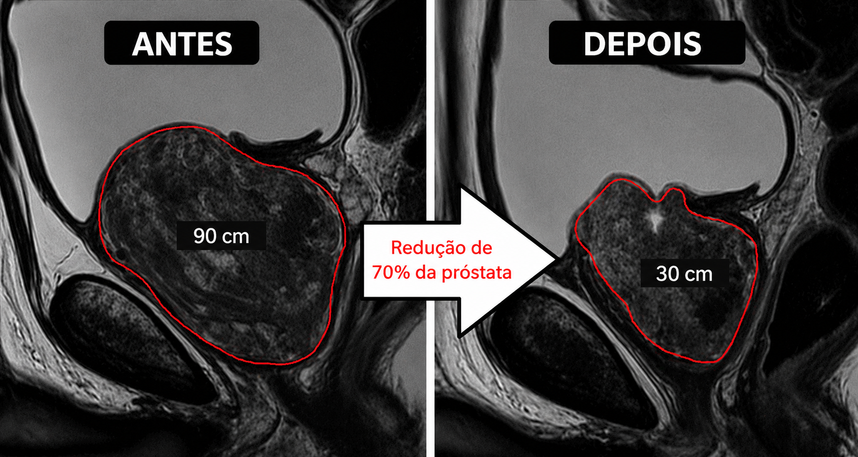 Comparativo